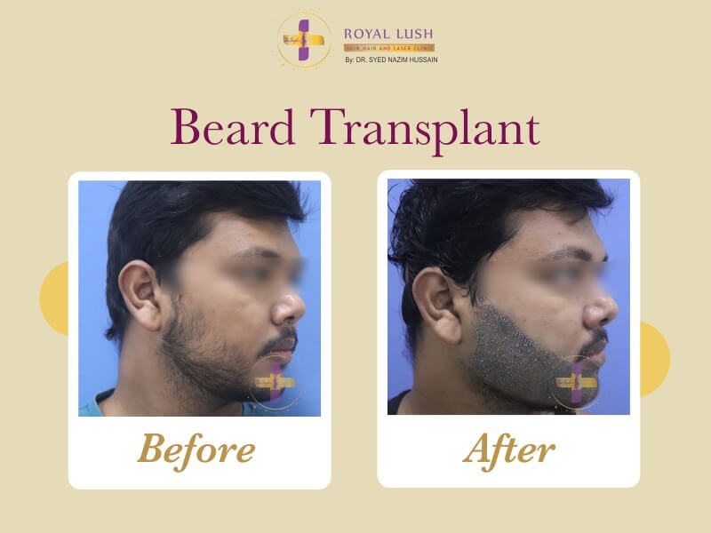 before-and-after-large-7-4 (1) (1)